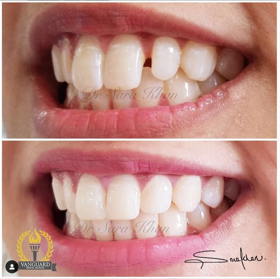 Vanguard Dental logo